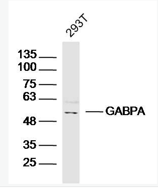 Anti-GABPA antibody-GA结合蛋白转录因子α/GABP-α抗体