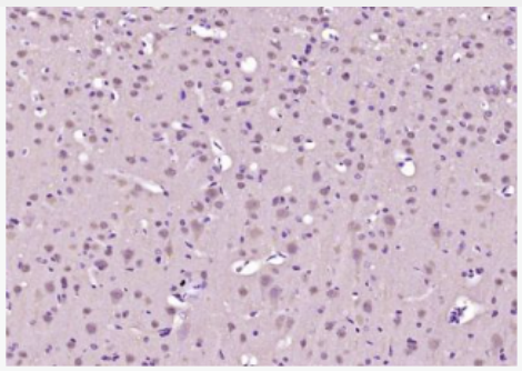 Anti-SHANK3 antibody-富含脯氨酸突触相关蛋白SHANK3抗体