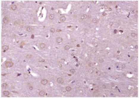 Anti-phospho-IRE1a (Ser 726) antibody-磷酸化内质网核信号转导蛋白a1抗体