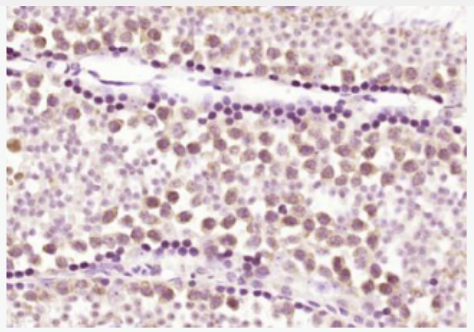 Anti-TET3  antibody-甲基胞嘧啶双加氧酶TET3抗体