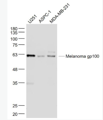 Anti-Melanoma gp100 antibody-黑色素瘤相关抗原gp100抗体