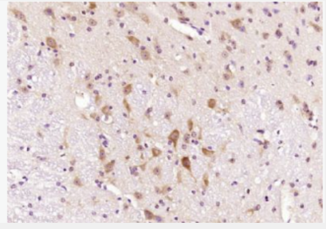 Anti-CRF1 antibody-促肾上腺皮质激素释放因子受体1抗体