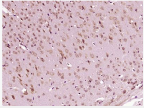 Anti-SAP30 antibody-组蛋白去乙酰化酶复合亚基SAP30抗体