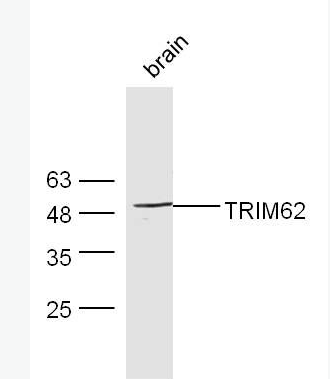 Anti-TRIM62 antibody-TRIM62蛋白抗体