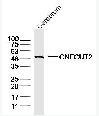 Anti-ONECUT2 antibody-转录因子ONECUT2抗体