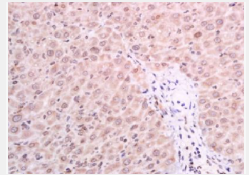 Anti-GSDMA antibody-gasdermin蛋白抗体