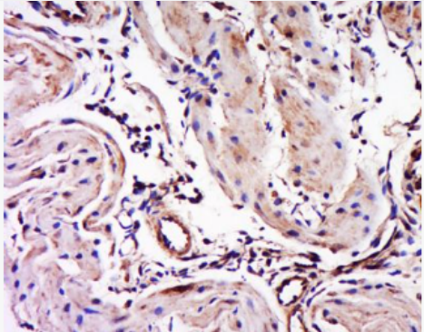 Anti-Myosin-3 antibody-肌球蛋白3抗体