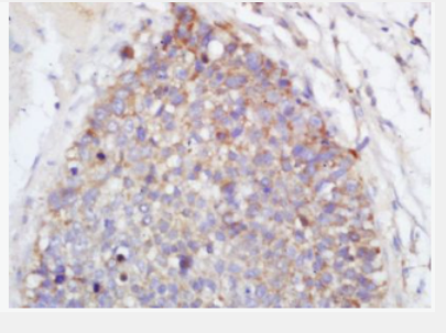 Anti-TLR2 antibody-Toll样受体2（CD282）抗体