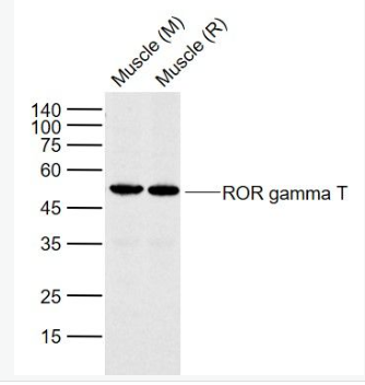 Anti-ROR gamma T antibody-维甲酸相关孤儿受体γt抗体