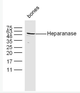 Anti-Heparanase antibody-乙酰肝素酶抗体