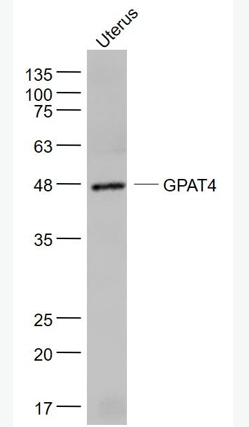 Anti-GPAT4 antibody-甘油-3-磷酸酰基转移酶4抗体