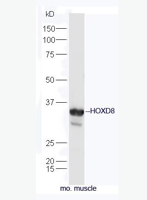 Anti-HOXD8 antibody-同源盒转录因子8抗体