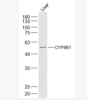 Anti-CYP8B1 antibody-细胞色素P450 8B1抗体