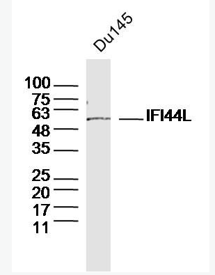 Anti-IFI44L antibody-干扰素诱导蛋白44样蛋白抗体