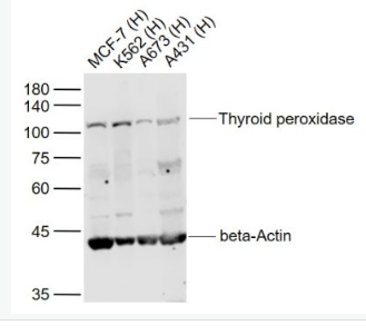 Anti-Thyroid peroxidase antibody-甲状腺过氧化物酶抗体