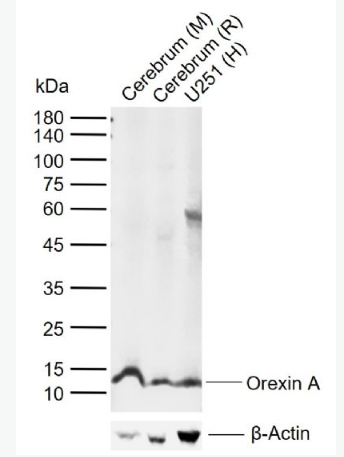 Anti-Orexin A antibody-增食欲素A/欲激素A抗体