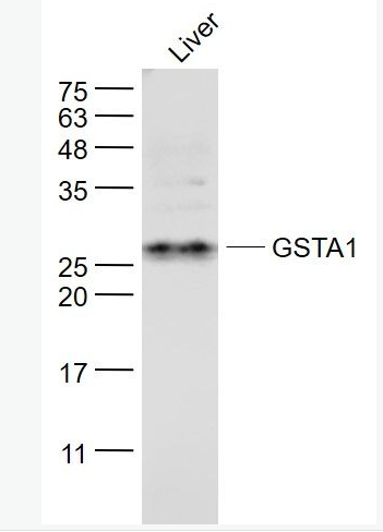 Anti-GSTA1  antibody-谷胱甘肽S转移酶α1抗体