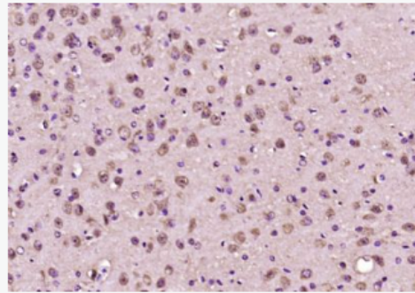 Anti-ABCB9 antibody-腺苷三磷酸结合盒转运体9抗体