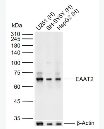 Anti-EAAT2 antibody-胶质细胞谷氨酸运载蛋白2抗体