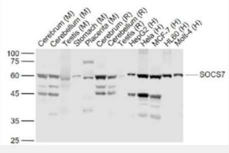 Anti-SOCS7 antibody-信号转导和转录激活因子7抗体