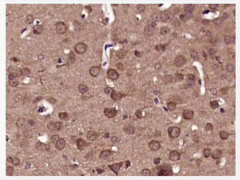 Anti-phospho-DNM1L (Ser616) antibody-磷酸化动力相关蛋白1抗体