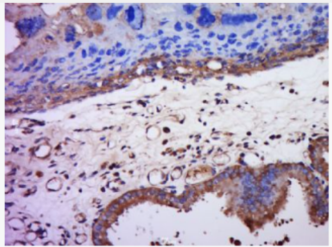 Anti-ZP2 antibody-卵透明带糖蛋白2抗体