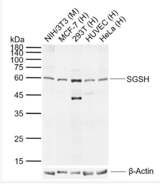 Anti-SGSH antibody-磺氨基葡糖硫酸胺酶抗体