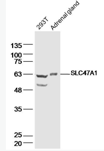 Anti-SLC47A1 antibody-溶质载体蛋白家族47成员A1抗体