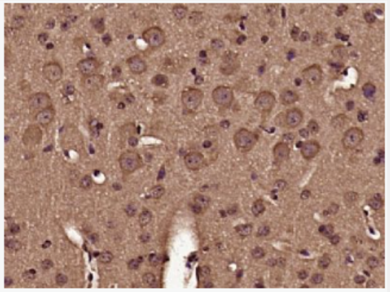 Anti-LC3A/B antibody-自噬微管相关蛋白轻链3A/3B抗体