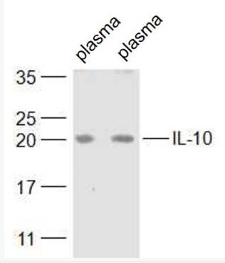 Anti-IL-10 antibody-白细胞介素10抗体