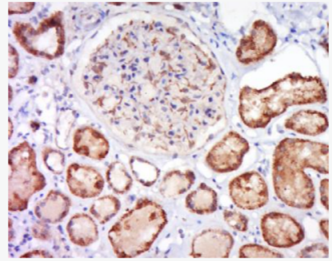 Anti-ALPPL2 antibody-碱性磷酸酶(类胎盘型)抗体