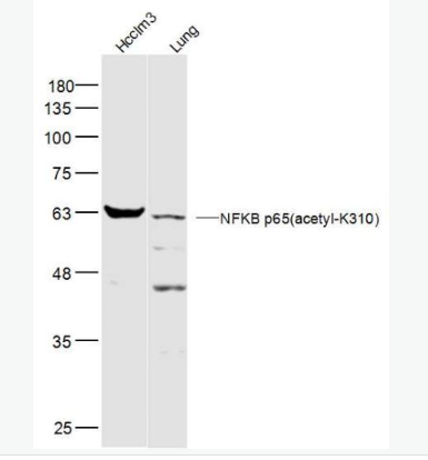 Anti-NFKB p65(acetyl K310) antibody-乙酰化细胞核因子NFKBp65抗体