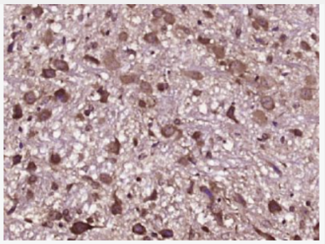 Anti-VDAC antibody-等电压依赖性阴离子通道抗体