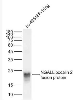 Anti-NGAL/Lipocalin 2 antibody-脂质运载蛋白抗体
