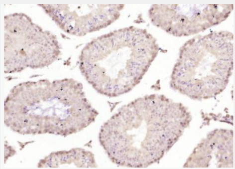 Anti-SOX6 antibody-核转录因子SOX6抗体