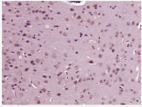 Anti-TRPV1 antibody-辣椒素受体抗体