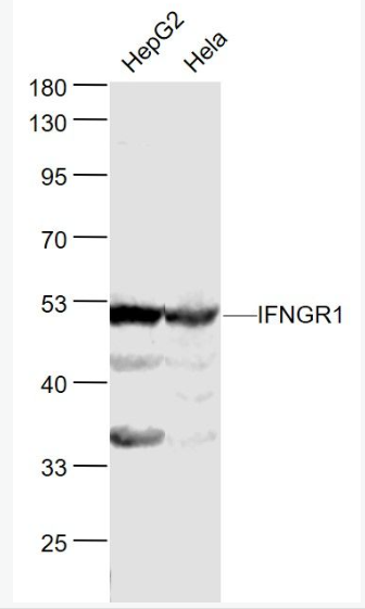 Anti-IFNGR1 antibody-干扰素-gamma受体1抗体