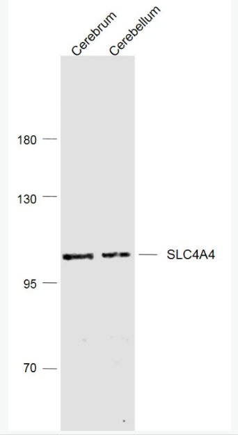 Anti-SLC4A4 antibody-碳酸氢钠协同转运蛋白4-A4抗体