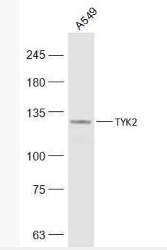 Anti-TYK2 antibody-非受体酪氨酸蛋白激酶2抗体