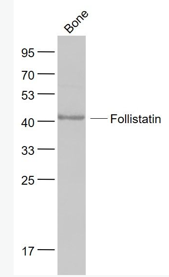 Anti-FS/Follistatin antibody-促卵泡激素抑释素/卵泡抑素抗体