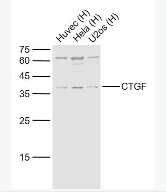 Anti-CTGF antibody-结缔组织生长因子抗体