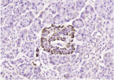 Anti-VEGFA antibody-血管内皮生长因子抗体