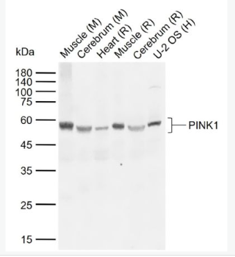 Anti-PINK1 antibody-丝氨酸/苏氨酸蛋白激酶PINK1抗体