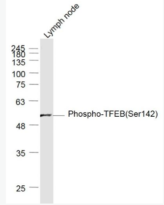 Anti-Phospho-TFEB(Ser142) antibody-磷酸化T淋巴细胞转录调节因子TFEB抗体