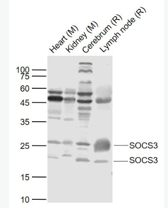 Anti-SOCS3 antibody-细胞因子信号传导抑制蛋白3抗体.