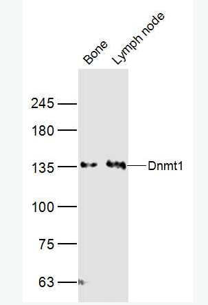 Anti-Dnmt1 antibody-DNA甲基转移酶1抗体