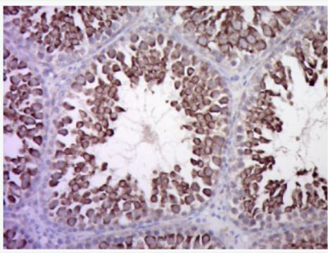 Anti-Calcitonin receptor  antibody-降钙素受体抗体