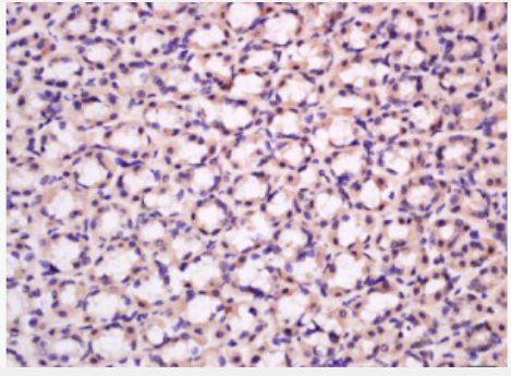 Anti-KCNMA1/BK channel antibody-钙激活钾通道蛋白 α 1抗体