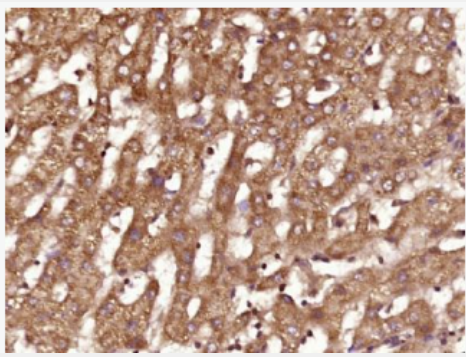 Anti-FGF3 antibody-纤维母细胞生长因子3抗体