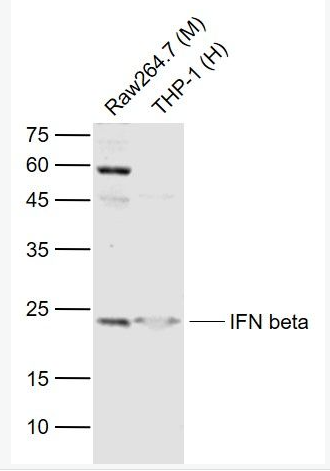 Anti-IFNB1 antibody-干扰素β抗体.